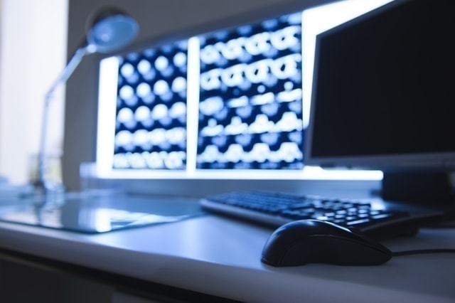 ガン治療イメージ