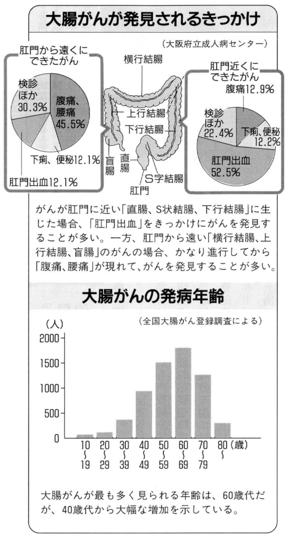 大腸がんが発見されるきっかけと発病年齢