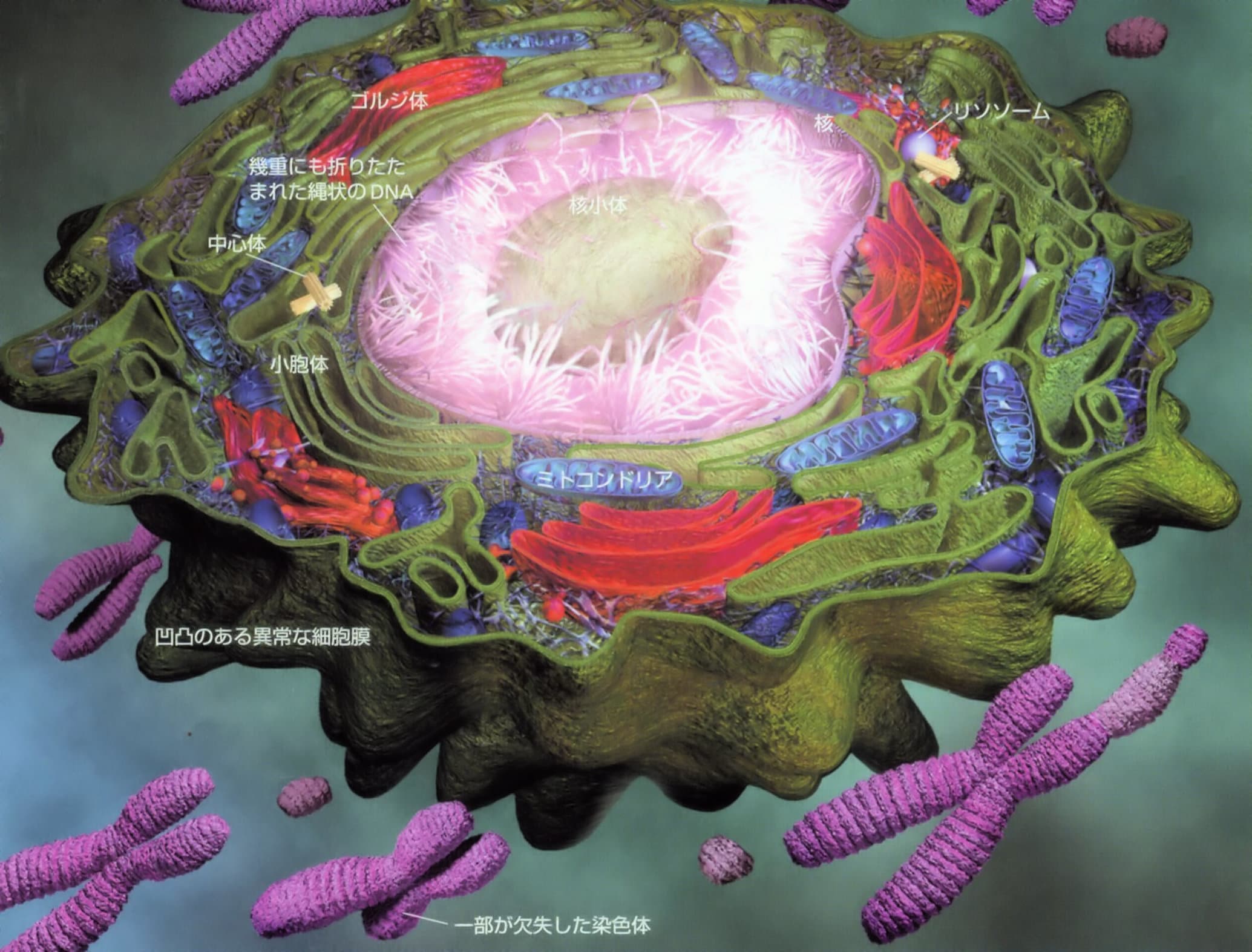 ガン細胞分解図（末期癌からの生還）